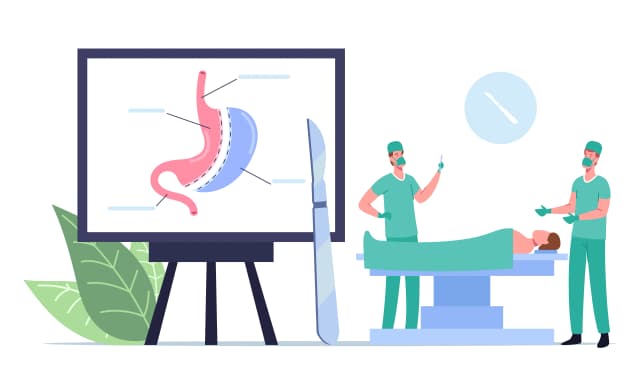 What Is a Gastric Sleeve & How Much Does It Cost?